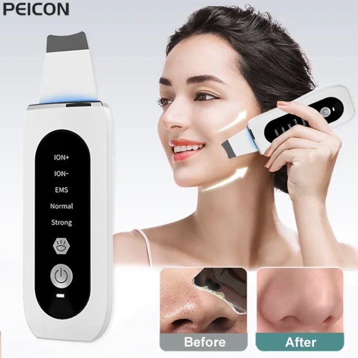 Ultrasonic Skin Scrubber | Ultrasonic Ion Cleaner | Blackhead Remover & Facial Skin Peeling Device | EMS Face Lifting Machine | Best Price in Bangladesh