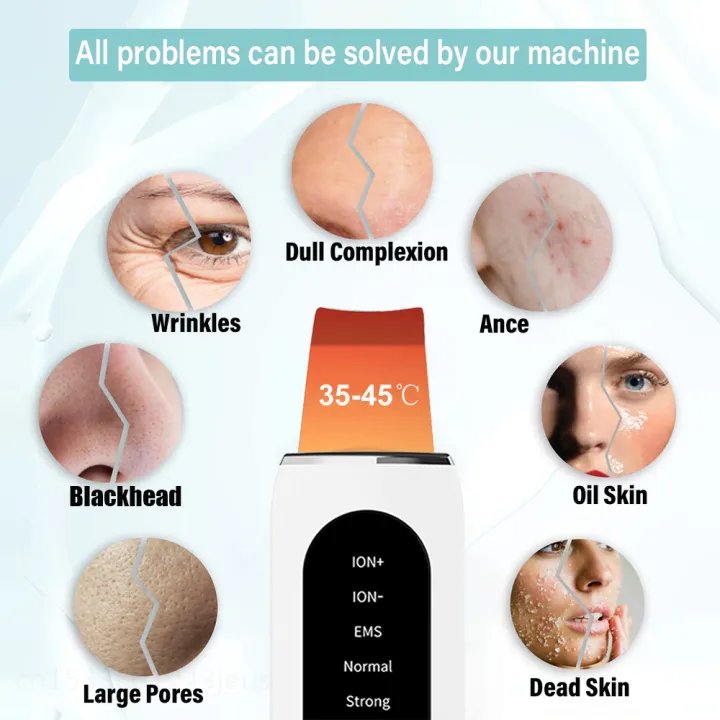 Ultrasonic Skin Scrubber | Ultrasonic Ion Cleaner | Blackhead Remover & Facial Skin Peeling Device | EMS Face Lifting Machine | Best Price in Bangladesh