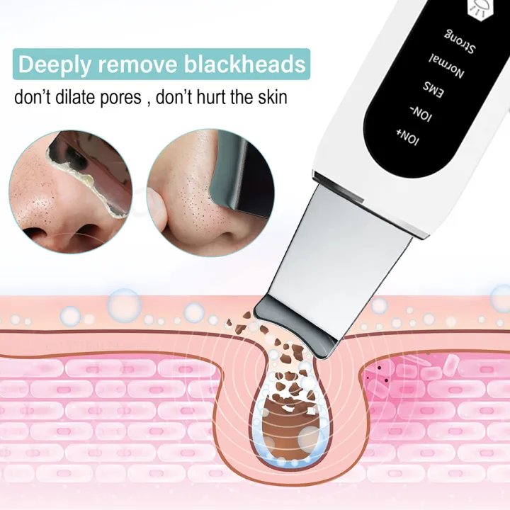 Ultrasonic Skin Scrubber | Ultrasonic Ion Cleaner | Blackhead Remover & Facial Skin Peeling Device | EMS Face Lifting Machine | Best Price in Bangladesh