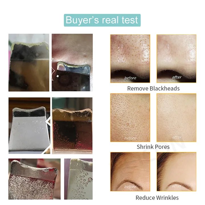 Ultrasonic Skin Scrubber | Ultrasonic Ion Cleaner | Blackhead Remover & Facial Skin Peeling Device | EMS Face Lifting Machine | Best Price in Bangladesh